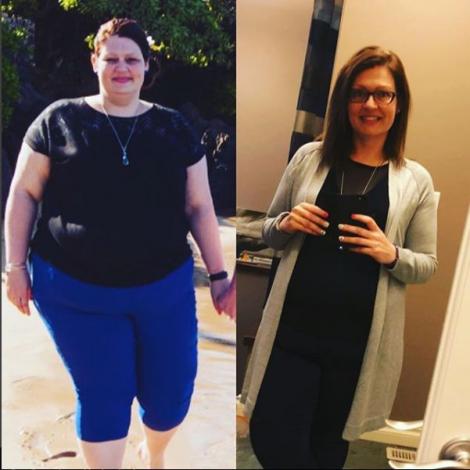 Amanda a slăbit 70 de kg cu doar trei sfaturi primite de la nutriționist! A dezvăluit SECRETELE gratuit, pentru a ajuta și alte femei