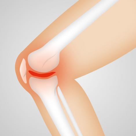 Trei cauze mai puțin știute pentru durerile de genunchi