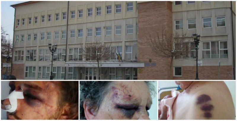 Caz revoltător în România! A snopit în bătaie o femeie, i-a dat foc la păr, dar a fost eliberat: Plângeam și îl rugam să nu mai dea"