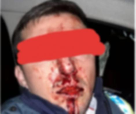 „Răzvan e tumefiat. SUTE de lovituri”! Un polițist a fost sechestrat și amenințat cu arma, în timpul unei urmăriri, în Vâlcea: „Au apăsat pe trăgaci, dar...”
