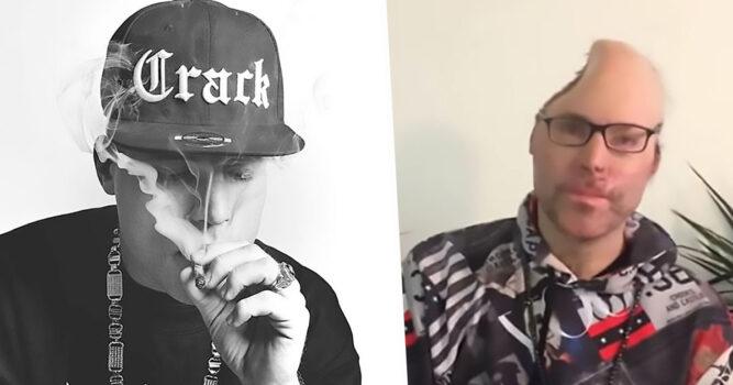 VIDEO/ A rămas mutilat pe viață! Un rapper și-a pierdut jumătate din cap într-o explozie provocată la un laborator de droguri