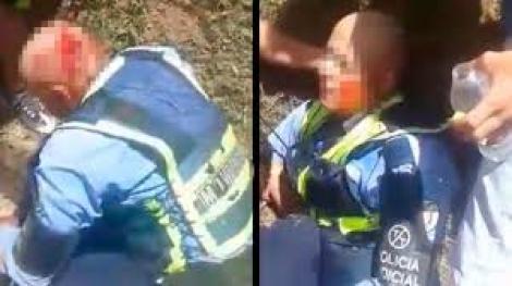 Revoltător! Un polițist a fost atacat cu toporul în cap de șoferul pe care l-a amendat