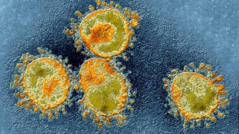 Cele mai periculoase 12 virusuri din lume: unul singur are o rată de mortalitate de 100%