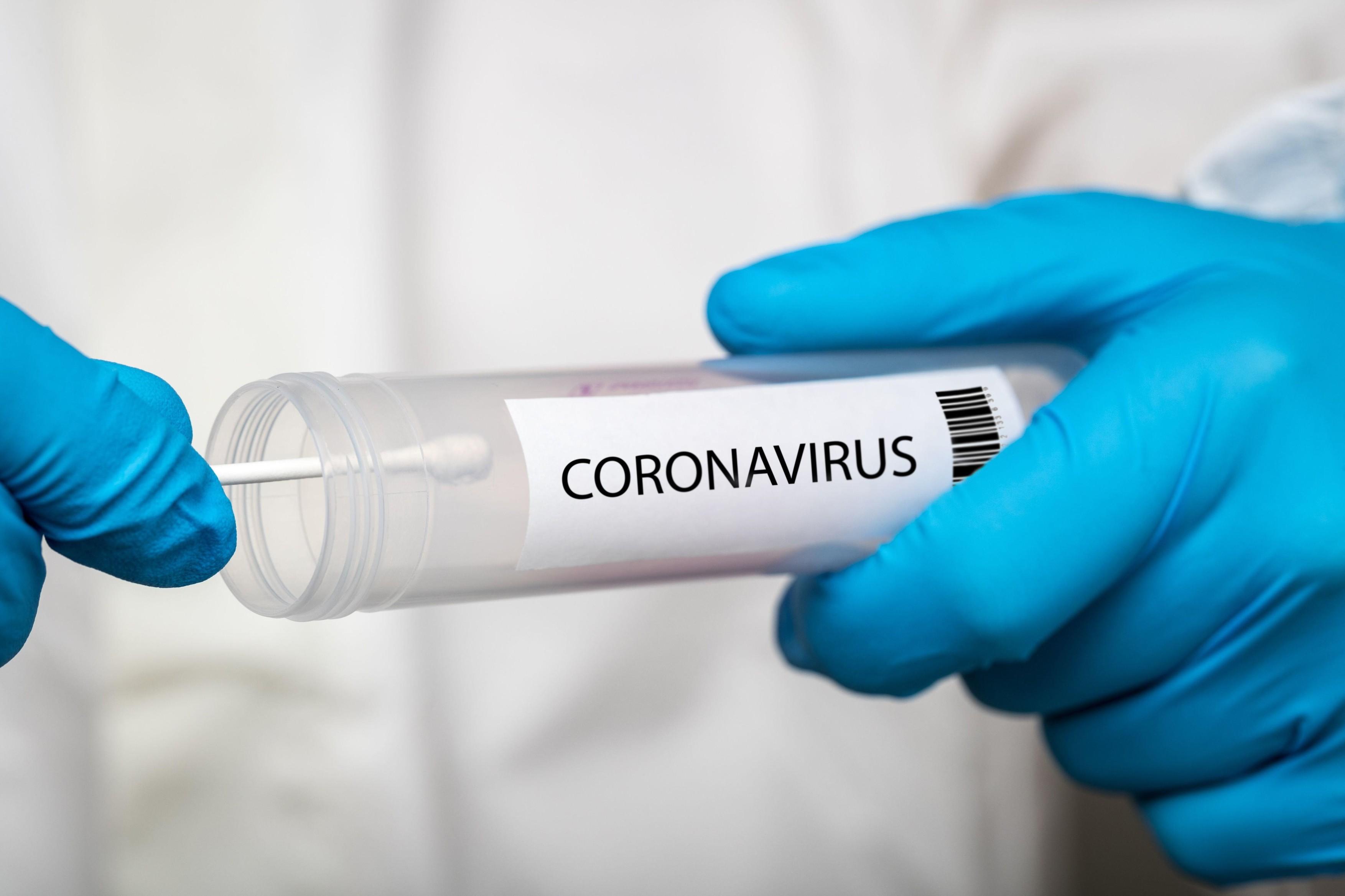 Câte teste pentru depistarea coronavirusului mai sunt în România, în acest moment? Ministerul Sănătății, informații oficiale