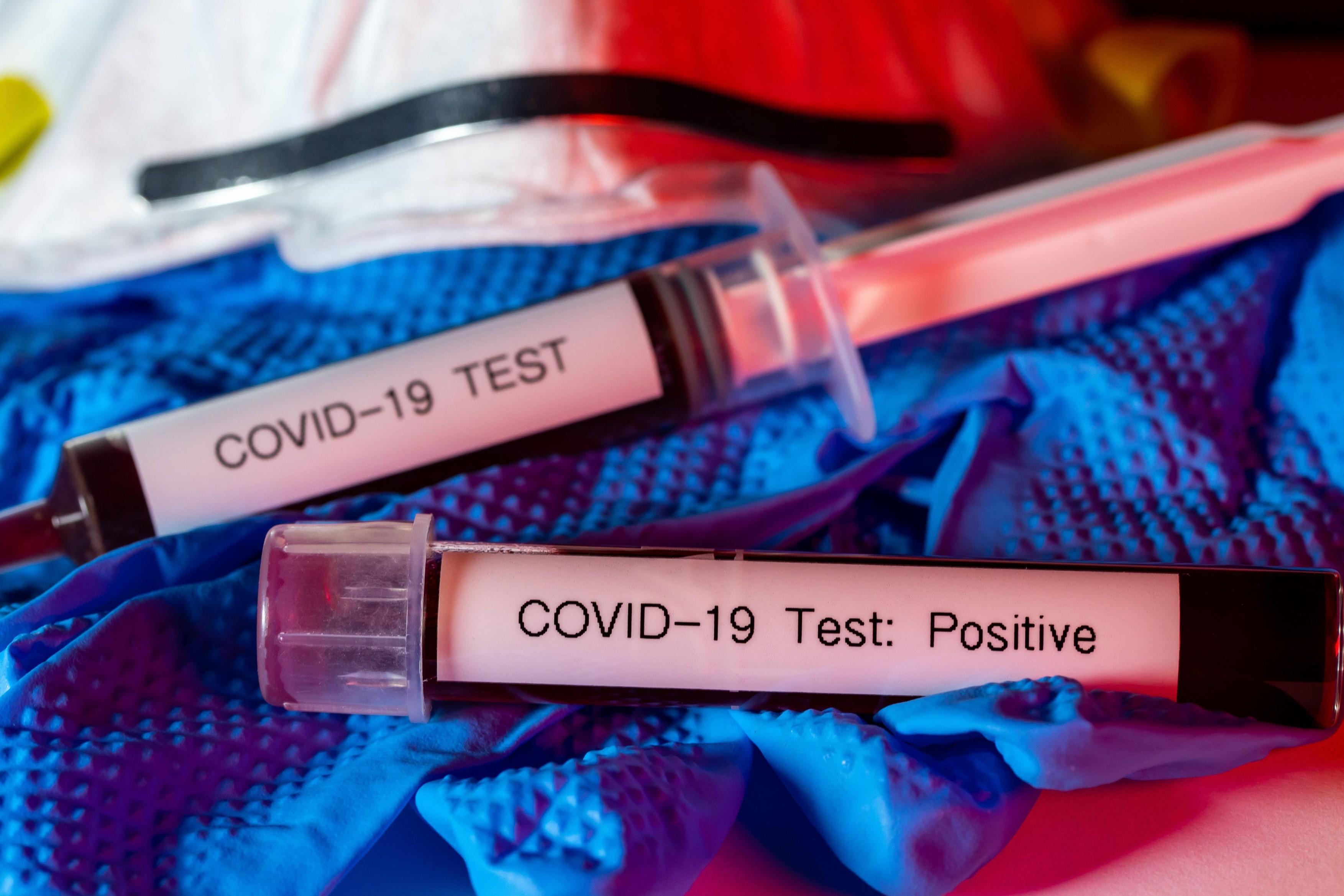 S-au schimbat regulile! Cine va fi testat, de acum încolo, de coronavirus? Ce simptome de COVID-19 vor căuta medicii?