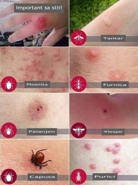 FOTO | Dicționarul mușcăturilor de insecte. Cum recunoști rănile provocate de căpușe, păianjeni, purici, țânțari sau ploșnițe