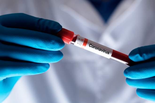 Bilanţul COVID-19 se menţine ridicat: 34 de morți din cauza coronavirusului și 1.075 de cazuri noi în România. Peste 400 de persoane la ATI