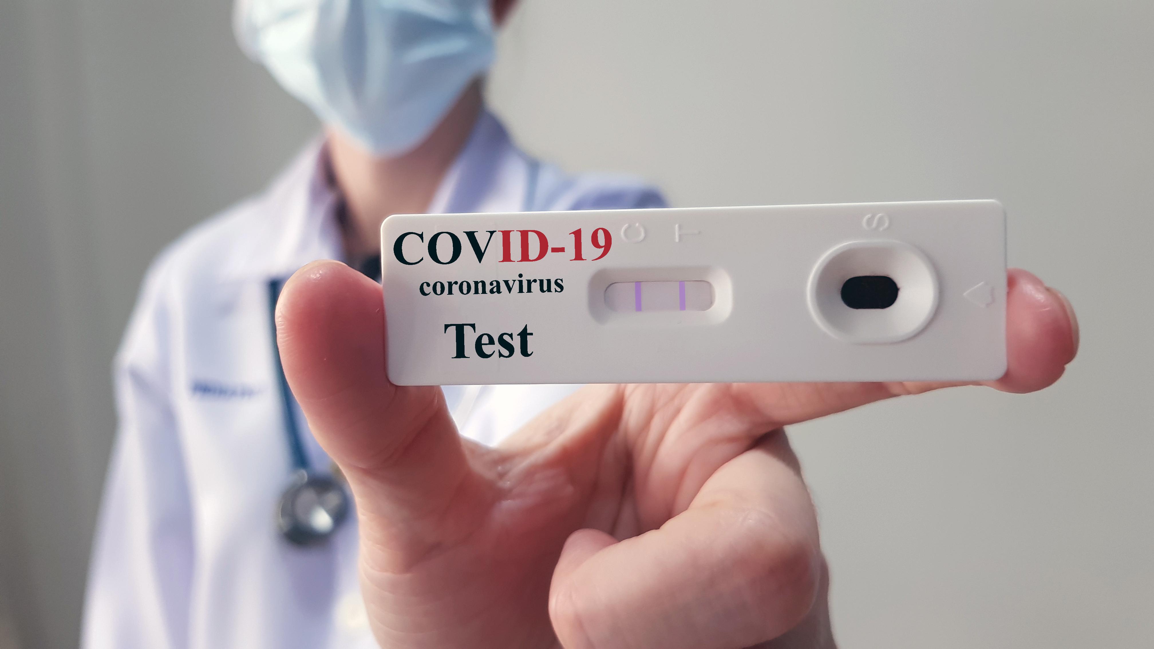 De ce testele de anticorpi sunt considerate "irelevante" pentru a determina dacă suntem protejați de coronavirus sau nu