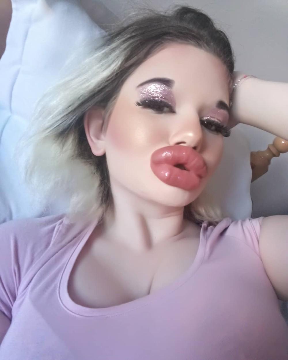 Big lip