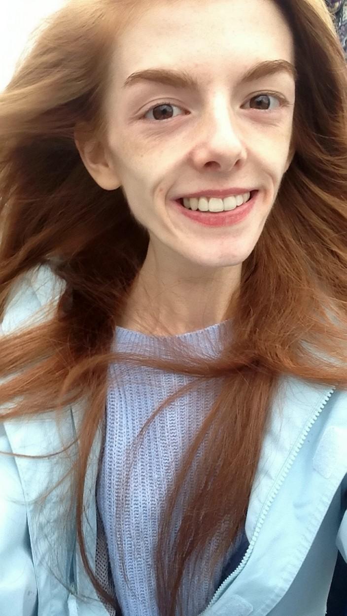 Annie Windley, selfie pe vremea când avea 28 de kilograme, în ținută bleu
