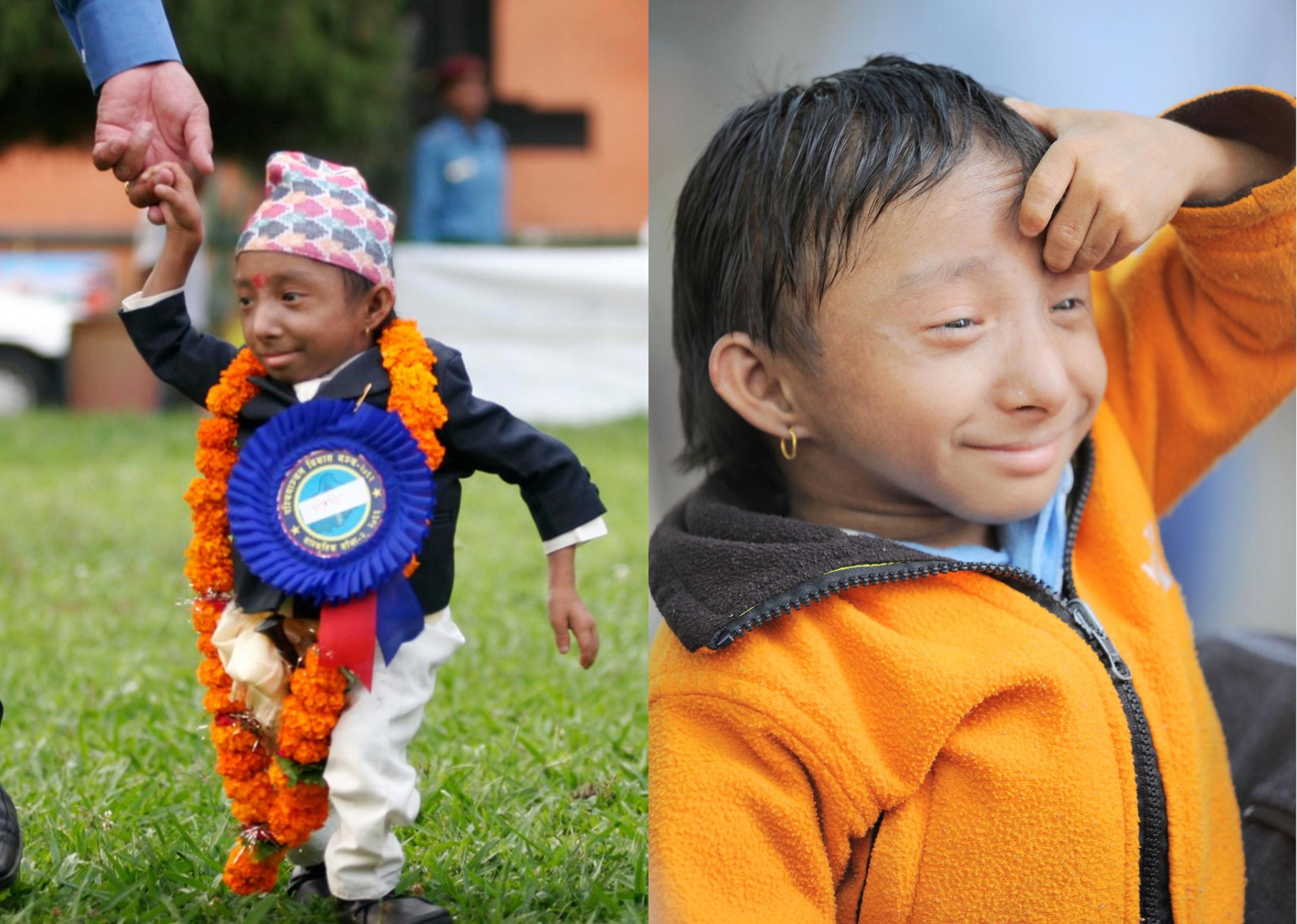 Khagendra Thapa Magar cel mai mic om din lume și s-a stins viață cauza unei boli grele. Câți ani avea a murit | Antena 1