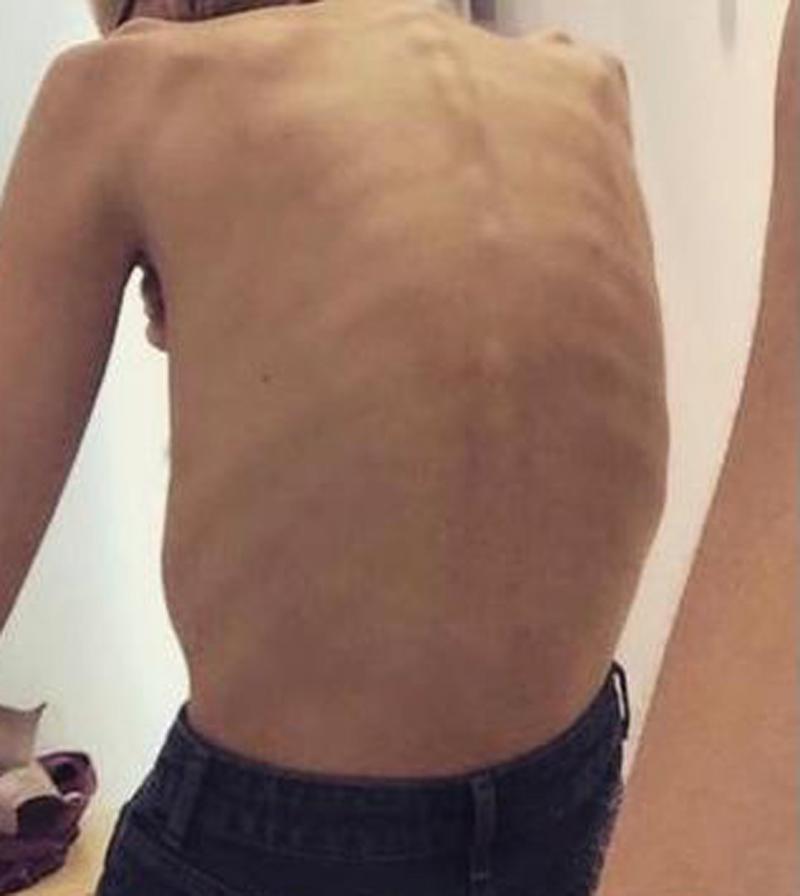 Charlie Bradburn, poză la spate, prin care se disting coastele