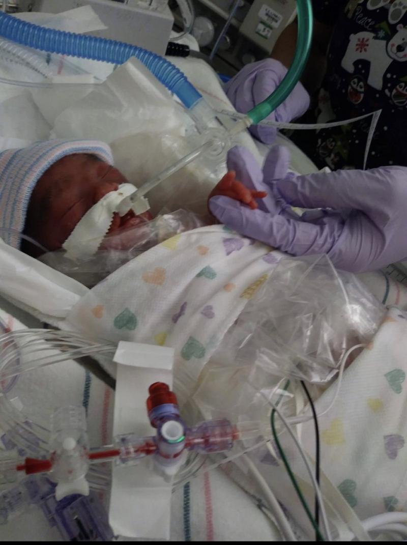 Prematurul născut de Dulce Munoz la terapie intensivă