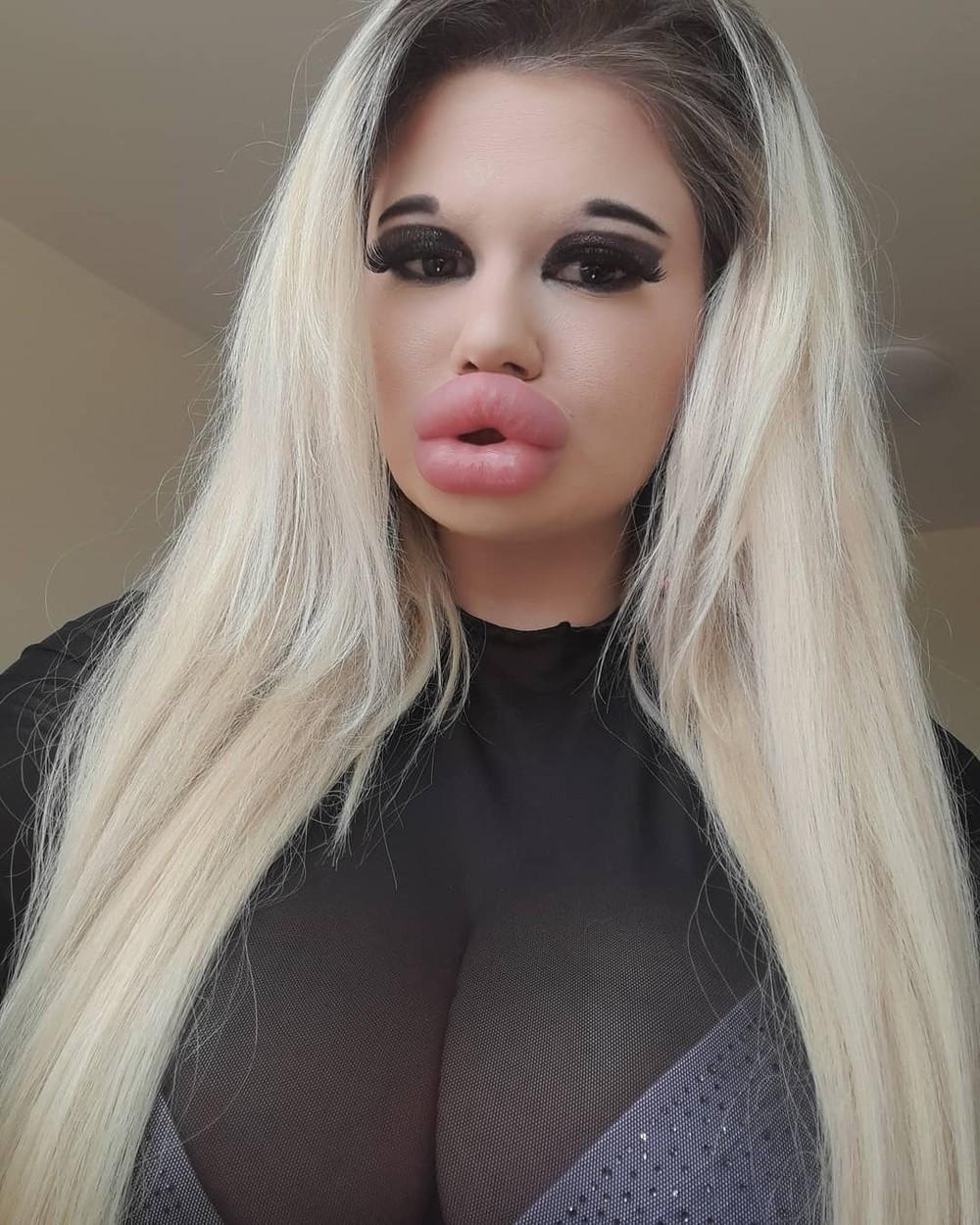 Andrea Ivanova, femeia cu cele mai mari buze din lume, vrea să aibă buzele și mai mari. Ce au averizat-o medicii