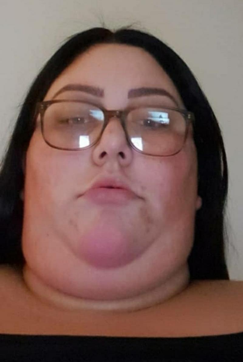 amanda nasse pe vremea cand avea 179 de kilograme