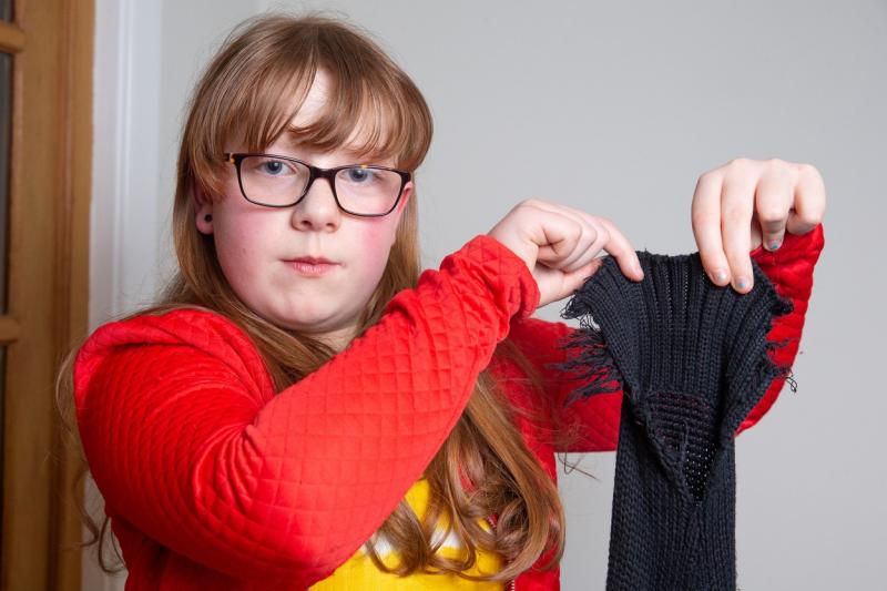 Jai Butler arătând haine mâncate de ea