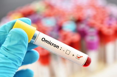 Ce crede Agenţia Europeană a Medicamentului despre Omicron. Ce schimbare aduce în plină pandemie