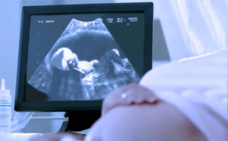 O femeie a privit ecografia bebelușului său și a descoperit ceva complet neașteptat. Imaginea văzută a lăsat-o fără cuvinte