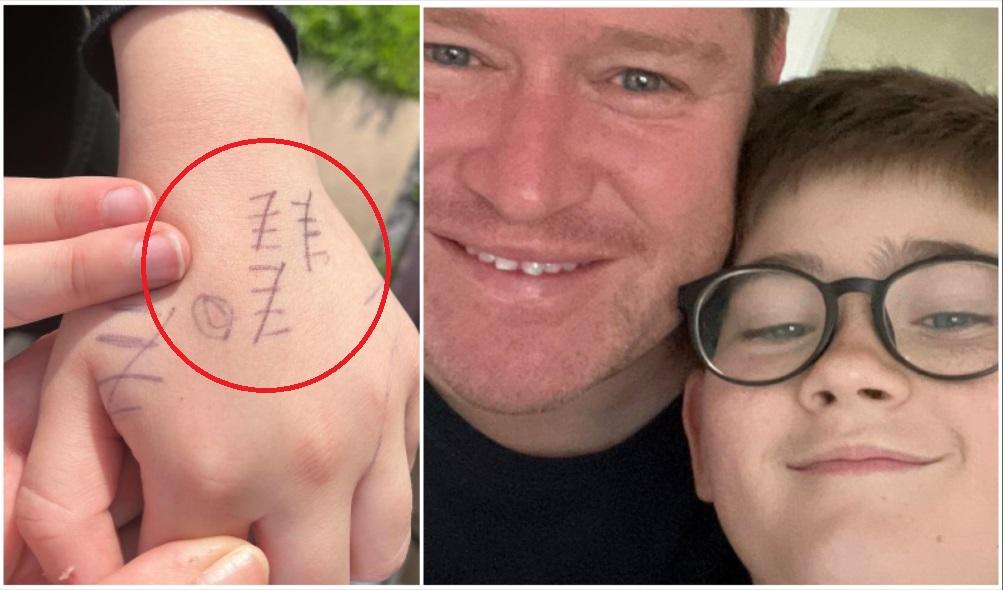 Un tată a descoperit semne ciudate pe mâna băiatului. Când și-a dat seama ce sunt, omului nu i-a venit să creadă. Ce a aflat