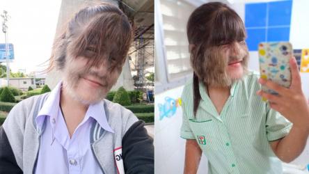 Cazul inedit al celei mai păroase femei din lume. Cum arată acum după ce s-a căsătorit și și-a îndepărtat tot părul