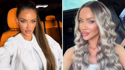 Cum arată Bianca Drăgușanu după ce și-a operat urechile. Vedeta a arătat rezultatul după intervenția controversată