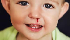 Sângerările nazale la copii: cum să le gestionezi corect