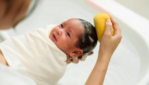 Ce cauzează scalpul uscat la bebeluși și cum se tratează