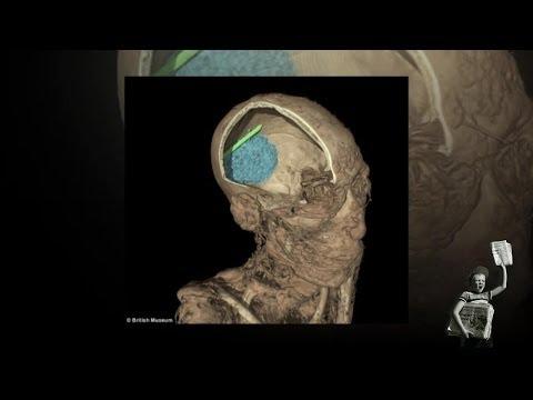 Descoperire șocantă în craniul unei mumii vechi de 2.600 de ani