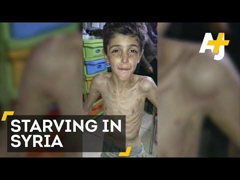 El e Abu și nu a mai mâncat nimic de șapte zile! Ca el mai sunt 40.000 de oameni, captivi într-un oraș ce a rămas fără mâncare de câteva luni!