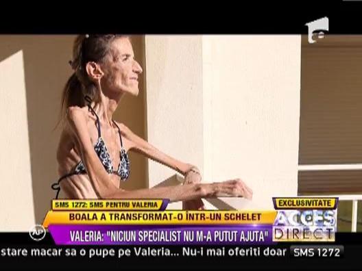 Imagini cutremuratoare: Valeria Levitin, femeia care cantareste 25 de kilograme, in costum de baie