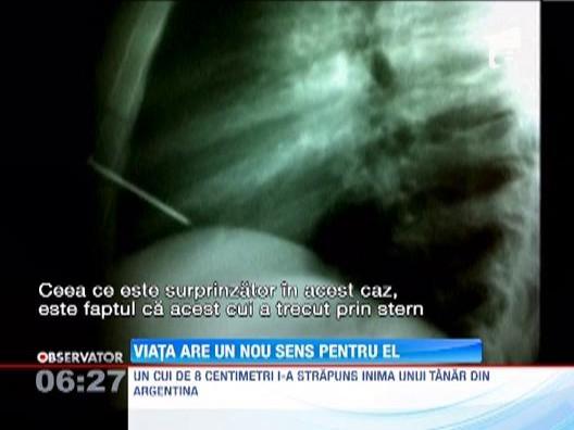 Un tanar din Argentina a supravietuit miraculos, dupa ce un cui de opt centimetri i-a strapuns inima
