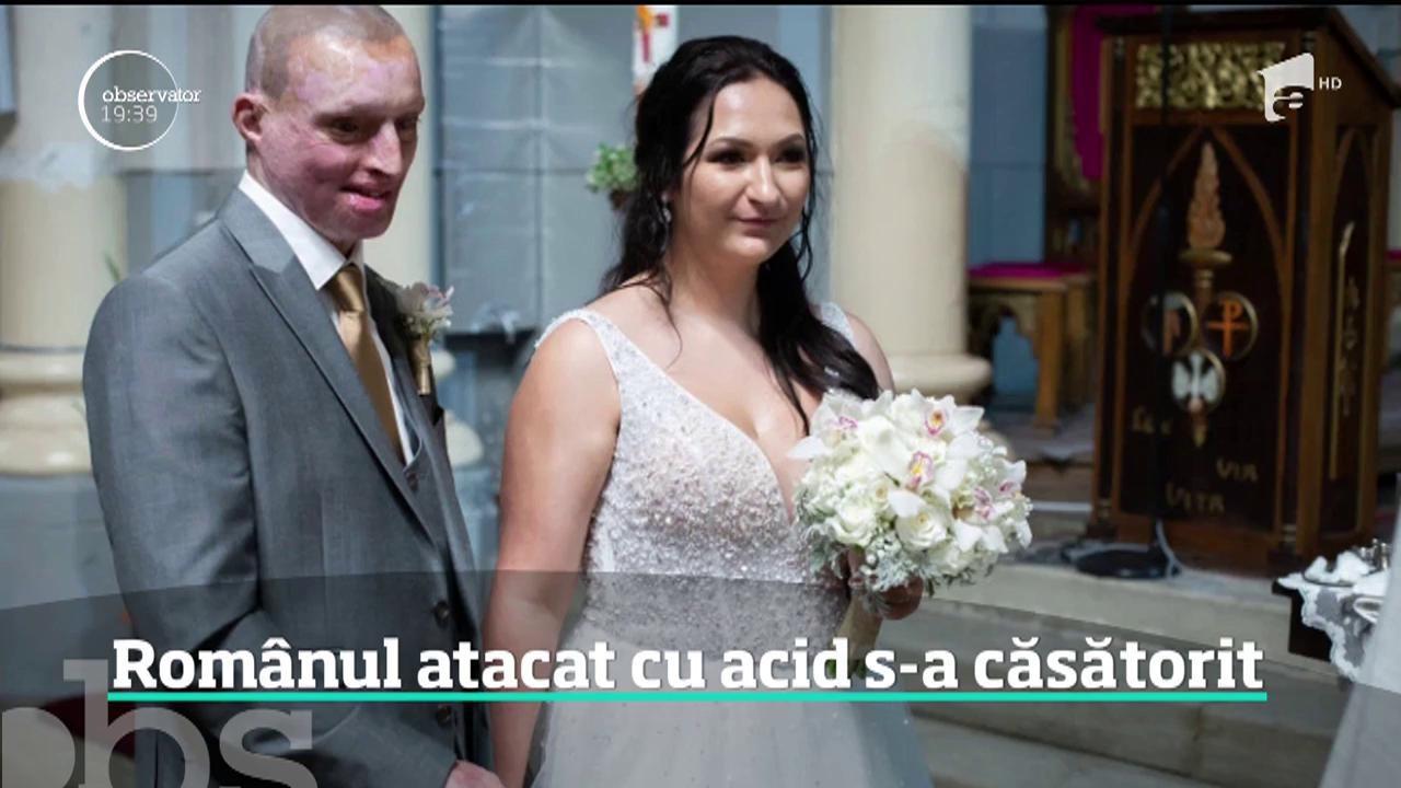 Daniel Rotariu, românul din Marea Britanie atacat cu acid de fosta iubită, s-a căsătorit cu infirmiera care l-a îngrijit după atac