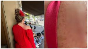 Oana Lis, imagini rare cu cicatricea rămasă după operația de cancer! Soția lui Viorel Lis, mai deschisă ca oricând