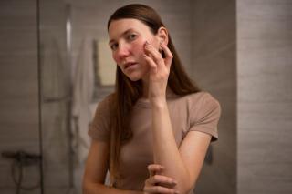 (P) Piele sensibilă sau afecțiune dermatologică? Cum îți dai seama