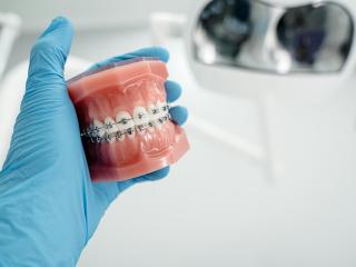 (P) 5 beneficii ale aparatului dentar