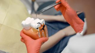 (P) Endodonția - ce înseamnă și de ce este importantă?