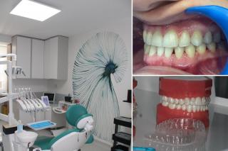 (P) Cât durează un tratament cu alignere invizibile Spark și care sunt etapele lui? Ghid explicat de medicii Dental Science