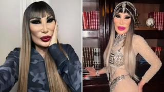 Așa arată acum, dar nu o să îți vină să crezi cât de frumoasă era în tinerețe! Înnebunea bărbații, însă operațiile au mutilat-o