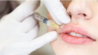 (P) Biostimulatori de colagen vs. acid hialuronic: două filozofii diferite, un singur scop