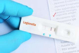 Ce este Legionella, bacteria contractată de angajata Metrorex după inundațiile din data de 1 iulie 2026