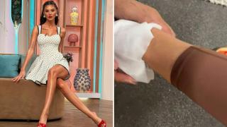 Ramona Olaru și-a speriat fanii după ce s-a afișat cu piciorul plin de sânge. Ce a pățit vedeta de la Neatza