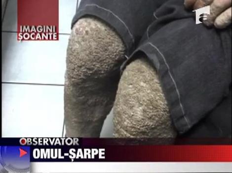 Omul-sarpe