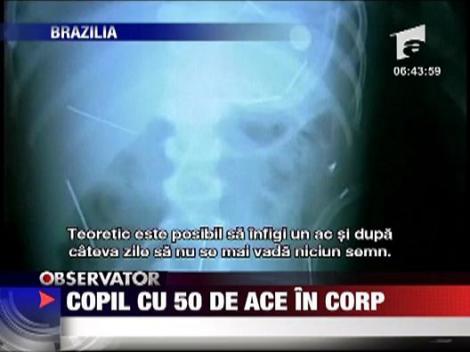 Copil cu 50 de ace in corp