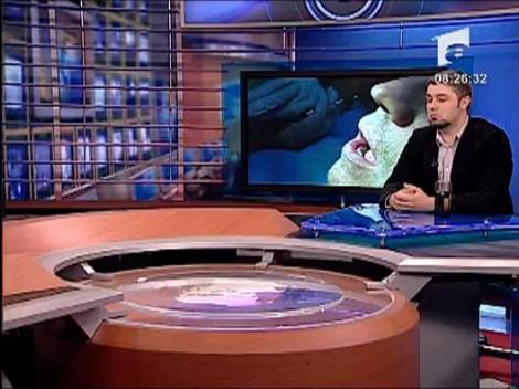 Cum sa ai un zambet perfect!