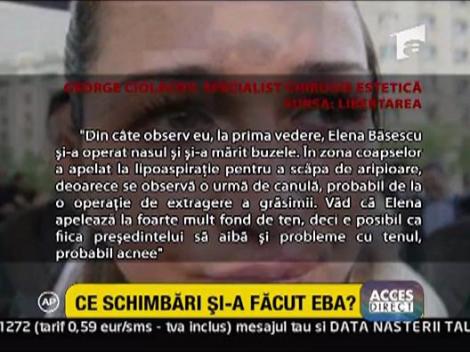 Alexandra Rus comenteaza posibilele operatii estetice ale Elenei Basescu