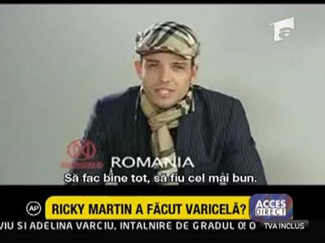 Ricky Martin a facut varicela?