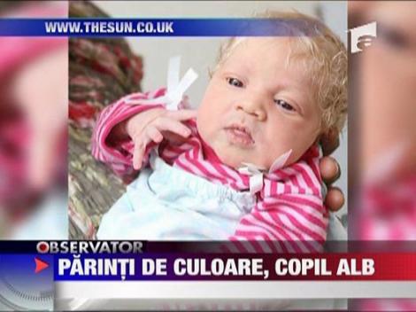 Un cuplu de culoare a adus pe lume un copil alb