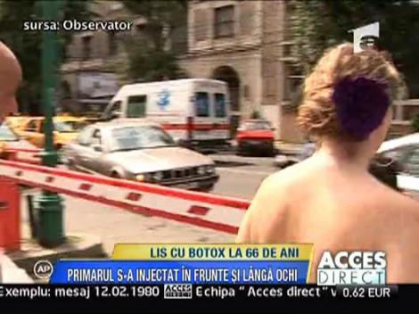 Viorel Lis si-a injectat Botox