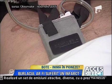 Botezatu a suferit al treilea infarct miocardic