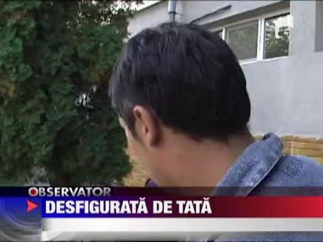 Desfigurata de tata! Batuta cu bestialitate!